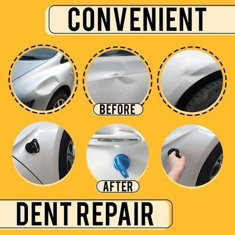 Dent Puller